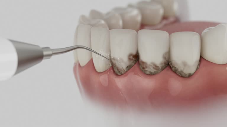 Trusted Root Canal Treatment service in Perryton, TX - Dentist Open Now